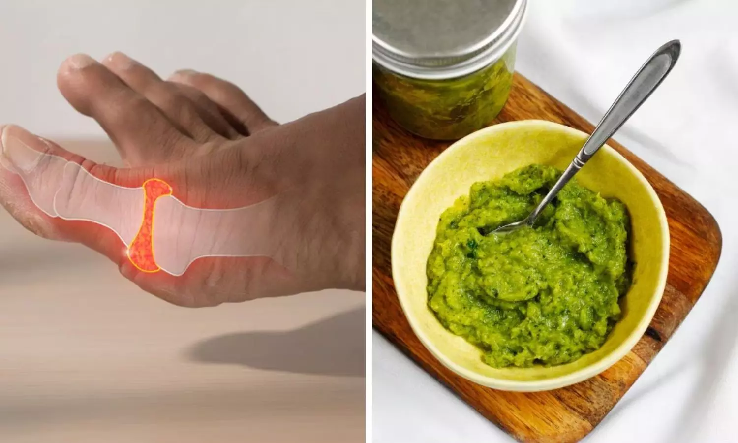 Green Chutney: ఈ ఆకు కూర యూరిక్ యాసిడ్ కిల్లర్.. శరీరంలో విష పదార్థాలు పరార్..! Green Chutney to Reduce Uric Acid Naturally Detox Body And Relieve Joint Pain Instantly