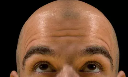 Regrow Hair on Bald Head Naturally Best Tips to Stop Hair Fall Fast