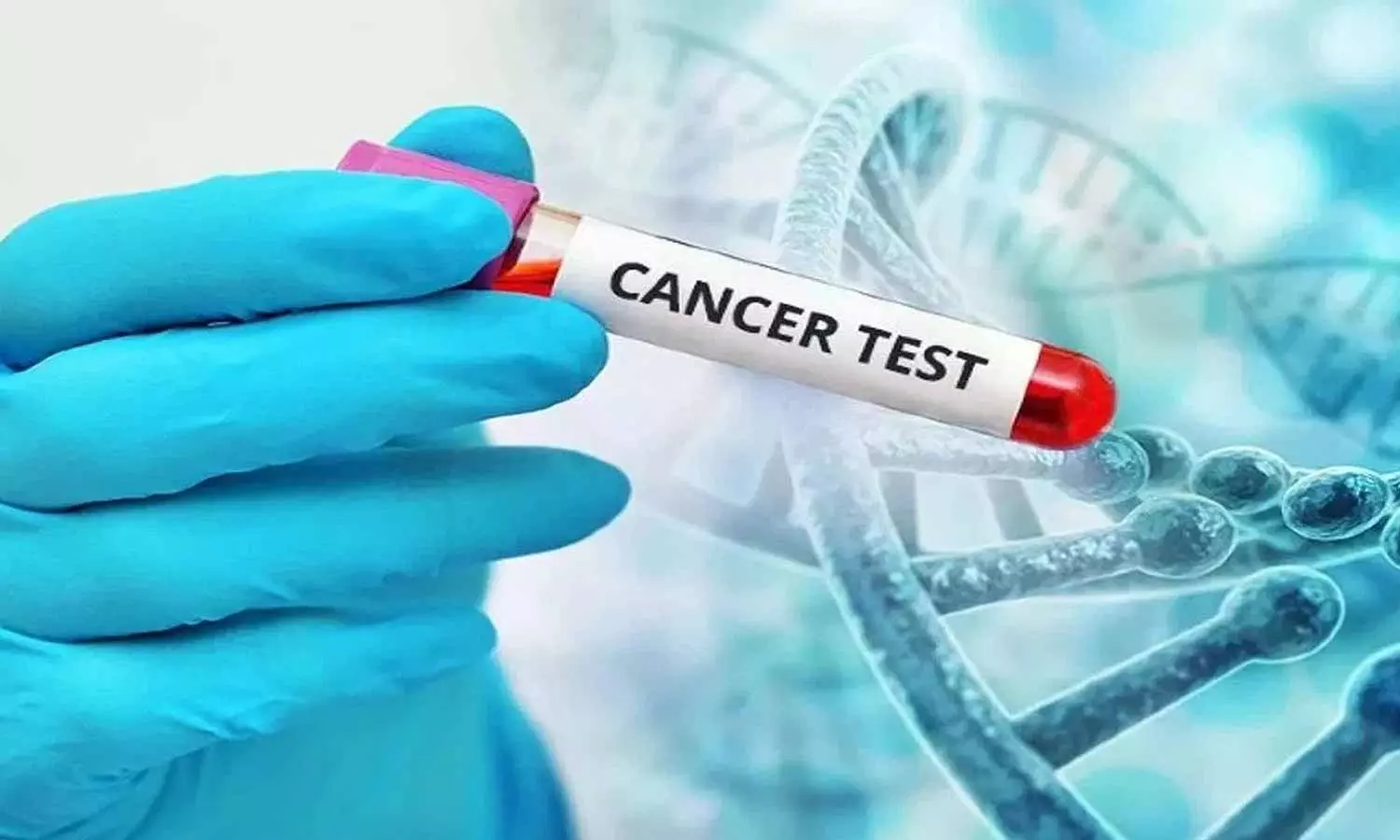 Cancer Patients: భారత్‌లో ఇక క్యాన్సర్ పేషెంట్ల జుట్టు రాలదు.. ఈ కొత్త టెక్నాలజీతో ట్రీట్‌మెంట్!