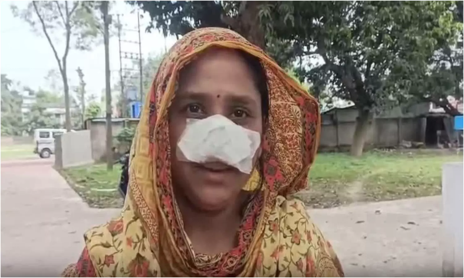 West Bengal: వీడికేం పోయేకాలం వచ్చింది.. భార్య ముక్కు అందంగా ఉందని కొరికేశాడు.. తర్వాత ఏం జరిగిందంటే?