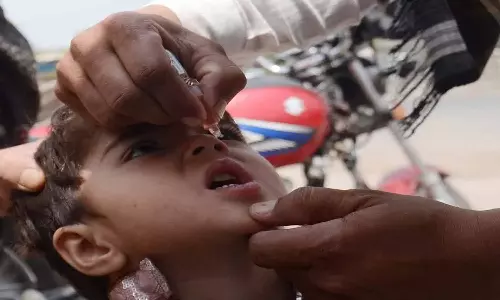 Polio in Pakistan Polio in Pakistan