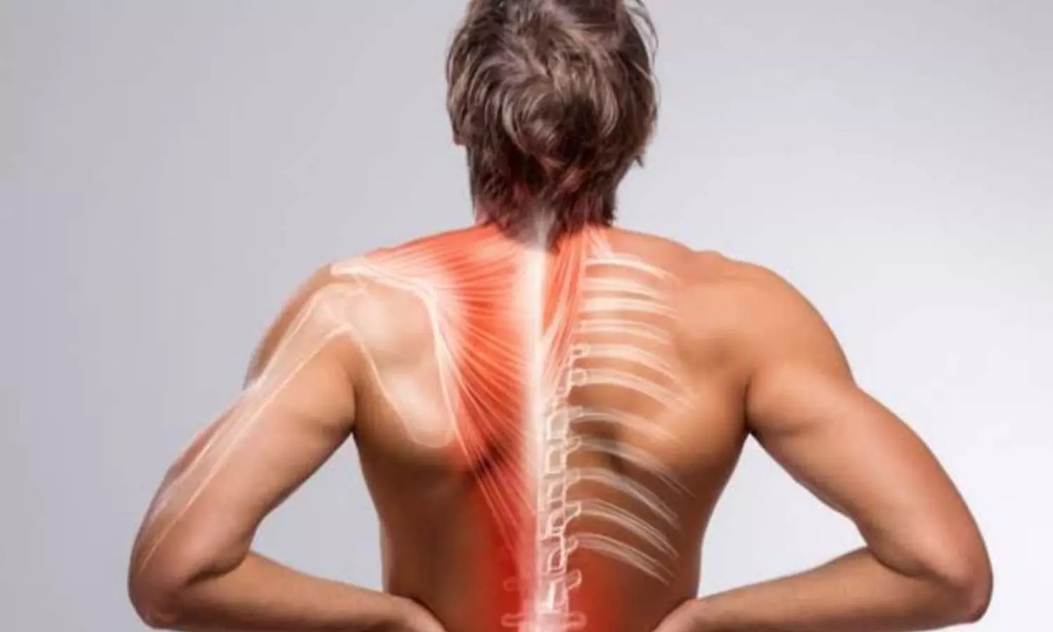 Muscle Pain Muscle Pain