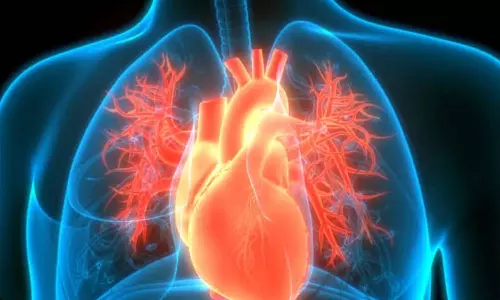 Food Items that are benefits for heart