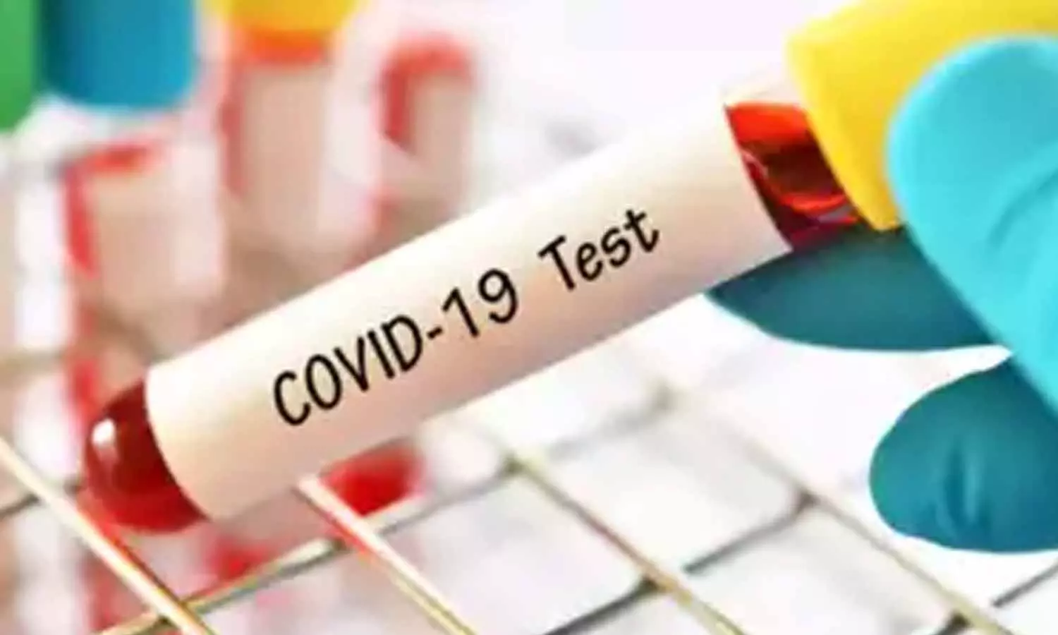Coronavirus cases in AP Coronavirus cases in AP