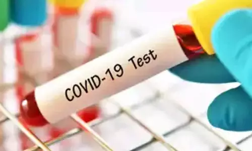 Coronavirus cases in AP