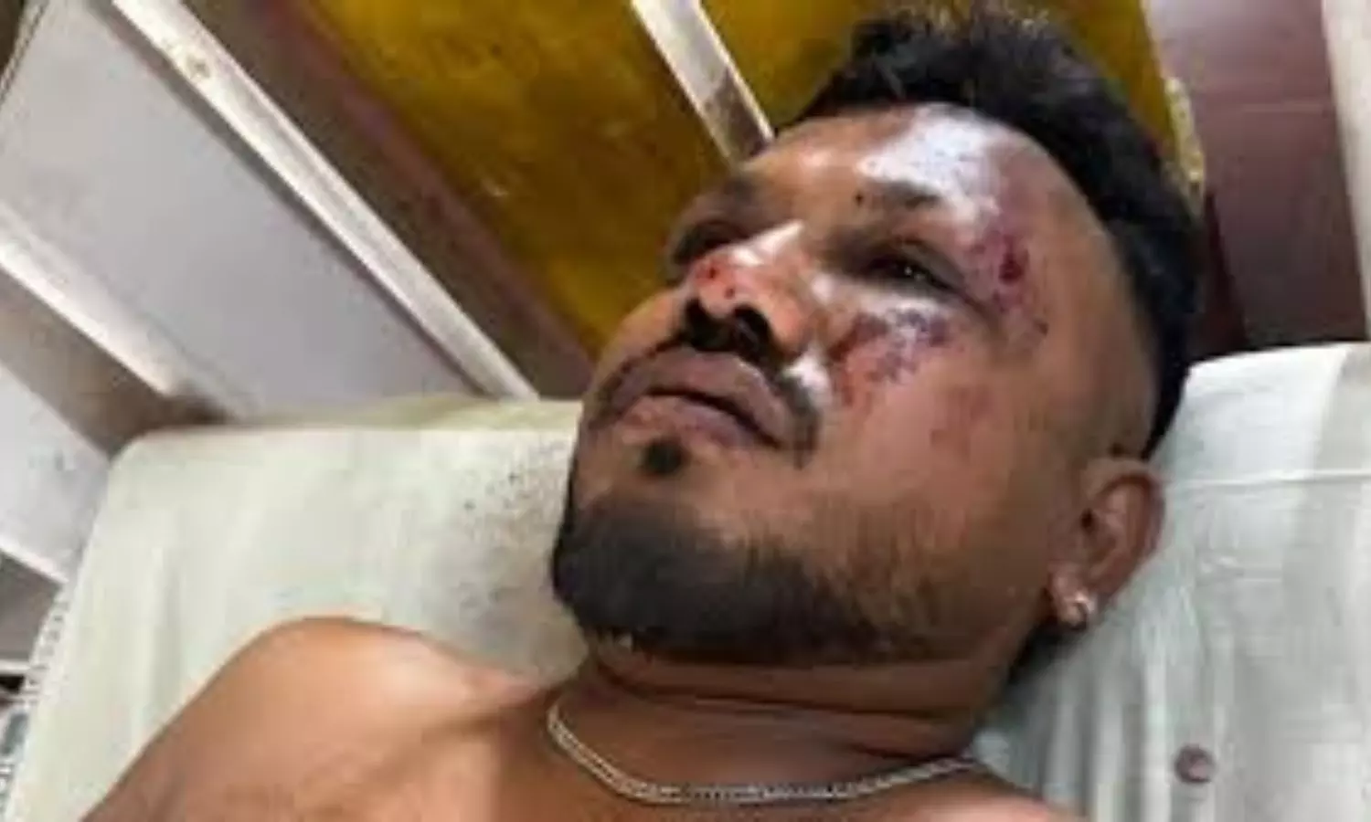 Air India Crash Survivor Vishwas Kumar: అందుకే నాకు మంటలు అంటుకోలేదు – ప్రాణాలతో బయటపడ్డ ఏకైక ప్రయాణికుడు