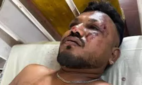 Air India Crash Survivor Vishwas Kumar: అందుకే నాకు మంటలు అంటుకోలేదు – ప్రాణాలతో బయటపడ్డ ఏకైక ప్రయాణికుడు Air India Crash Survivor Vishwas Kumar: అందుకే నాకు మంటలు అంటుకోలేదు – ప్రాణాలతో బయటపడ్డ ఏకైక ప్రయాణికుడు