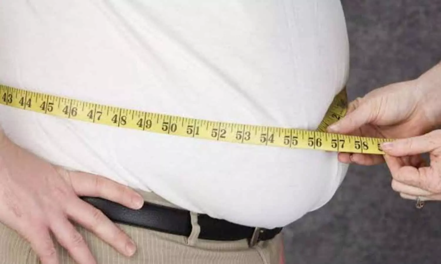 Obesity