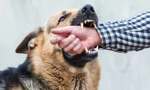 Dog Bite