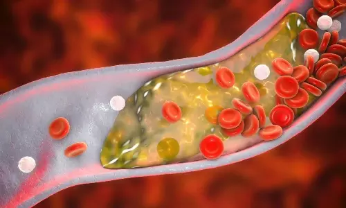 Dont Ignore These Warning Signs of Blockages Dont Ignore These Warning Signs of Blockages