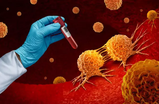 Cancer survey: ఆ ఒక్కచోటే 14,542 మంది మహిళల్లో క్యాన్సర్‌ అనుమానిత లక్షణాలు!