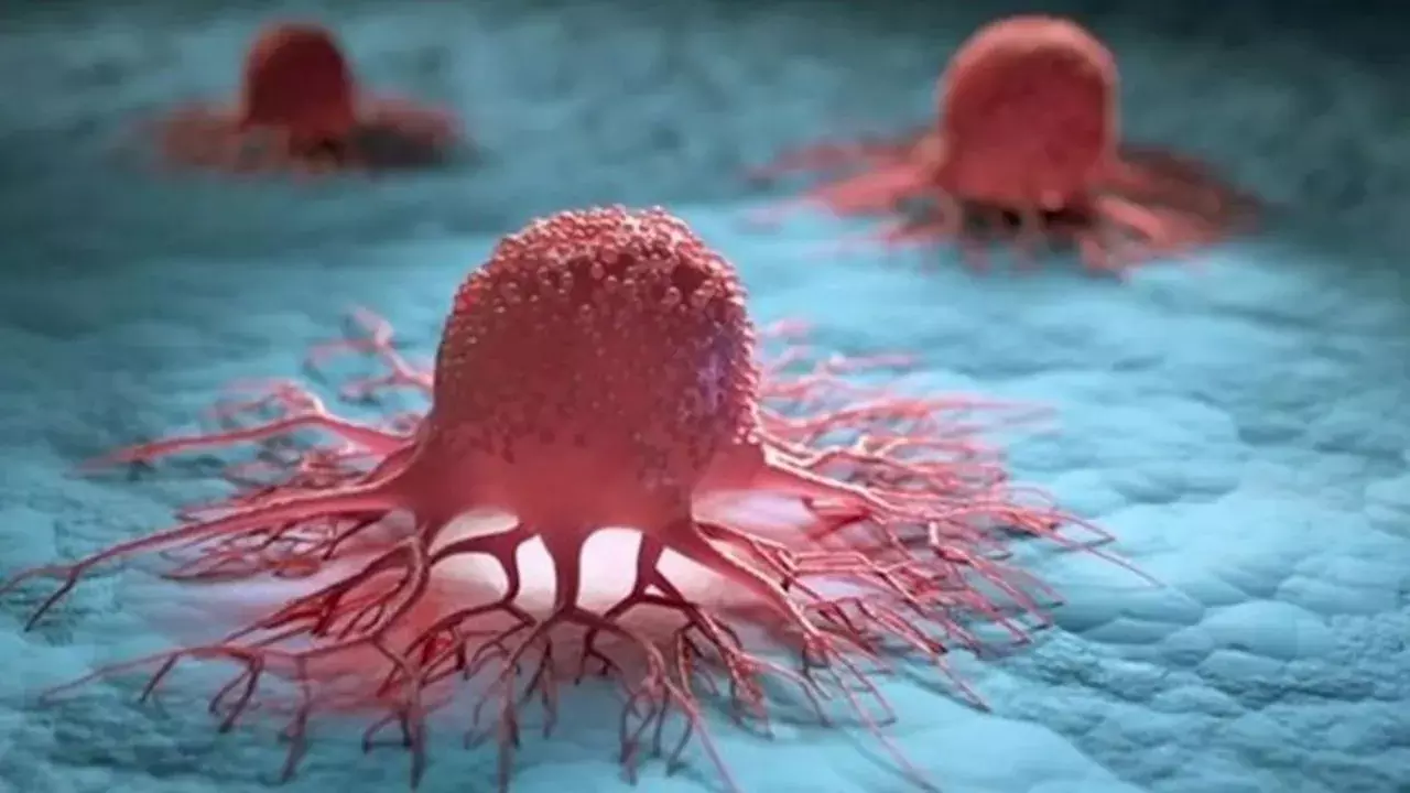 Cancer Risk: సిగరెట్ తాగకున్నా, మద్యం సేవించకున్నా వీళ్లకు క్యాన్సర్ వచ్చే ప్రమాదం ఉంది..! Cancer Risk: సిగరెట్ తాగకున్నా, మద్యం సేవించకున్నా వీళ్లకు క్యాన్సర్ వచ్చే ప్రమాదం ఉంది..!