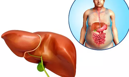 Gallbladder Stones Gallbladder Stones