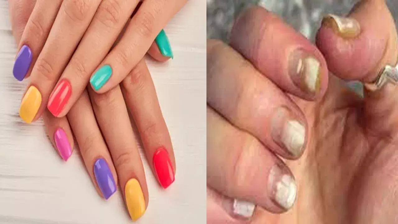 Beauty Care Tips: నెయిల్ పాలిష్ వాడకం జాగ్రత్త..! గోళ్ల ఆరోగ్యానికి ఎందుకు హానికరమో తెలుసా? Beauty Care Tips: నెయిల్ పాలిష్ వాడకం జాగ్రత్త..! గోళ్ల ఆరోగ్యానికి ఎందుకు హానికరమో తెలుసా?