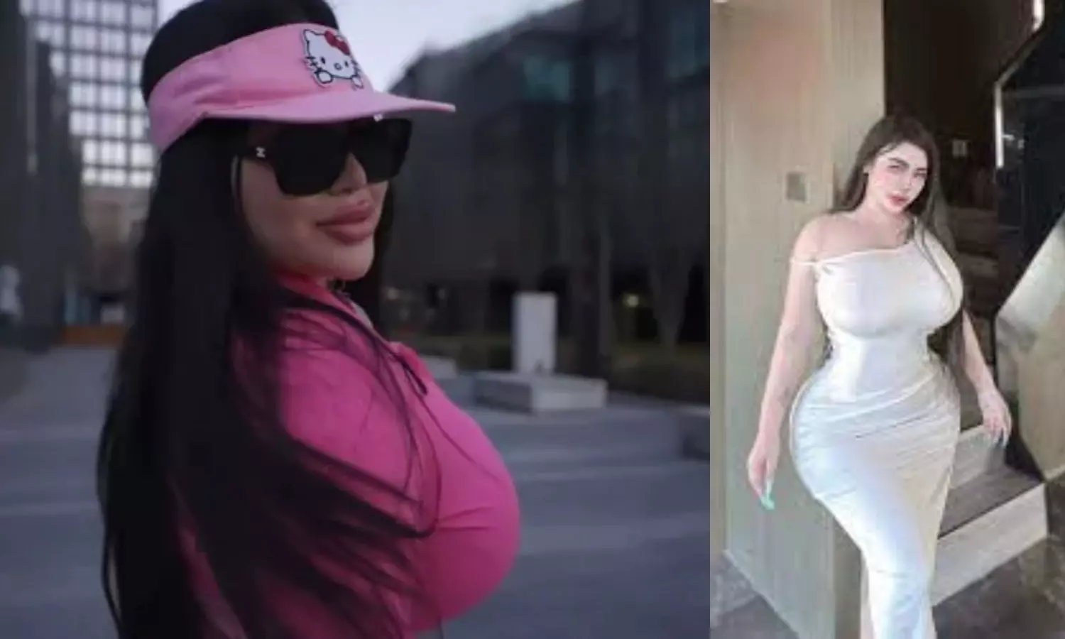 Rib Removal For Slim Waist: అందంగా కనిపించాలని బాడీ మొత్తం సర్జరీలు.. ఆఖరుకు పక్క టెముకలు కూడా Rib Removal For Slim Waist: అందంగా కనిపించాలని బాడీ మొత్తం సర్జరీలు.. ఆఖరుకు పక్క టెముకలు కూడా