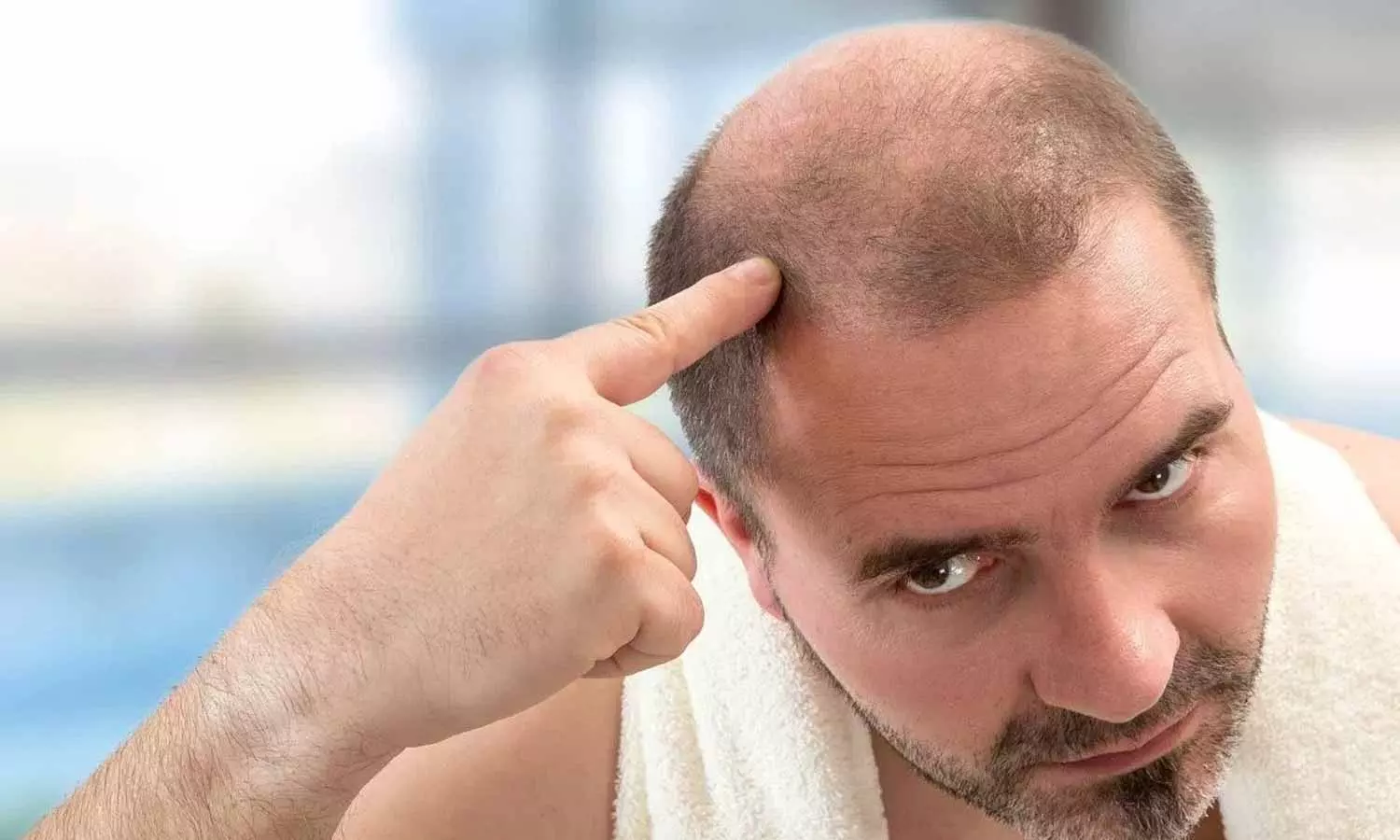 Hair Loss