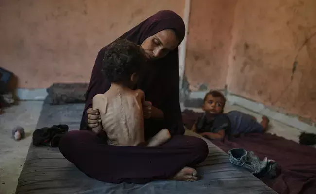 Starvation: ‘ఏడిస్తే కన్నీళ్లు రావట్లేదు.. పిట్టల్లా రాలిపోతున్న చిన్నారులు’ – గాజాలో హృదయ విదారక పరిస్థితి