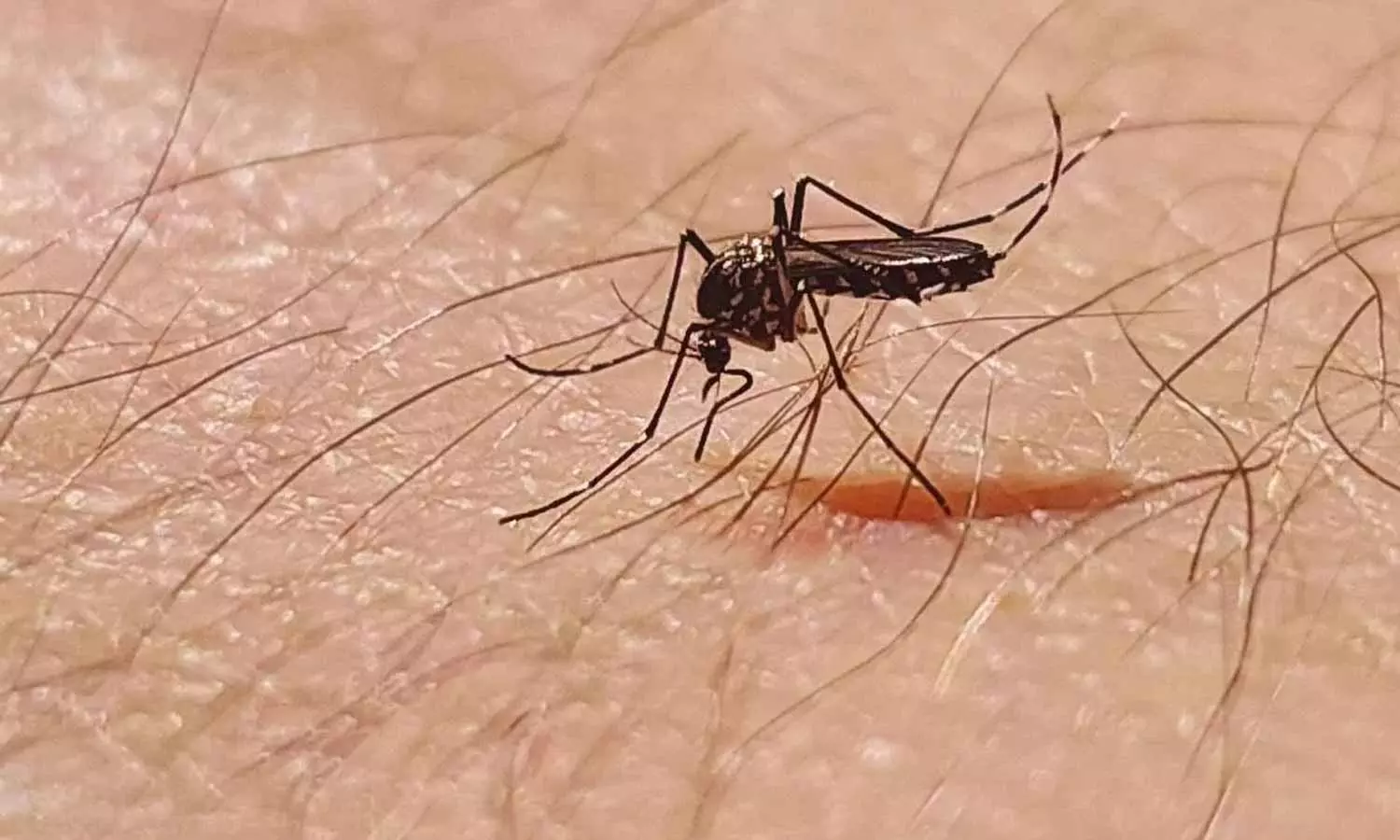 Chikungunya Chikungunya