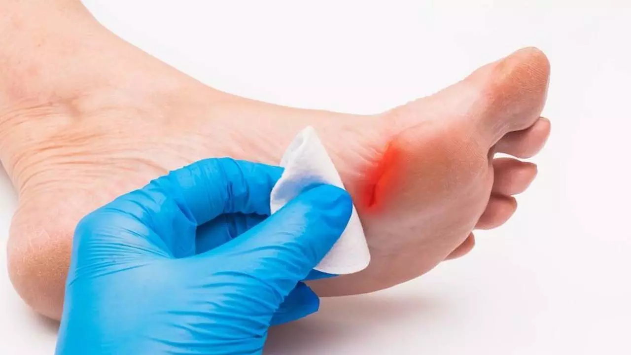 Diabeties: డయాబెటిస్ పేషెంట్స్‌కి గాయాలు త్వరగా ఎందుకు మానవు?