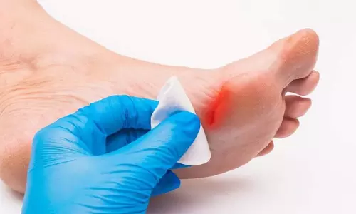 Diabeties: డయాబెటిస్ పేషెంట్స్‌కి గాయాలు త్వరగా ఎందుకు మానవు?