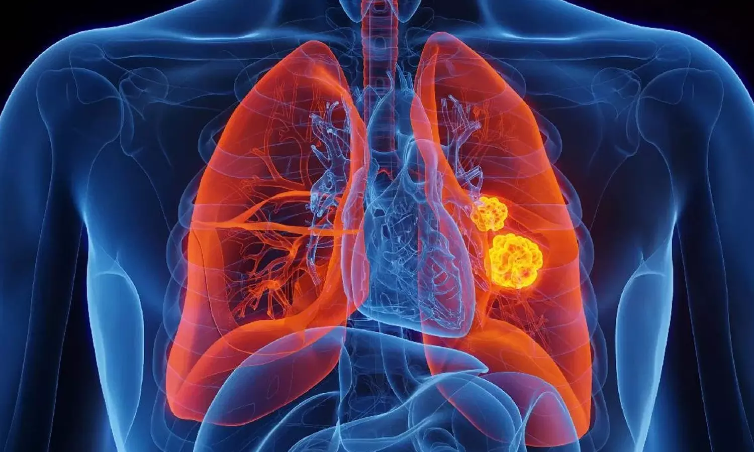 Beyond Cigarettes How Pollution, Diet, and Lifestyle Affect Lung Health