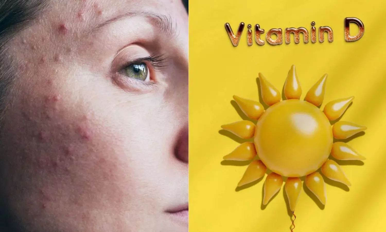 Vitamin D : మీ ముఖంలో ఈ లక్షణాలు కనిపిస్తున్నాయా? అయితే మీకు విటమిన్ డి లోపించినట్లే