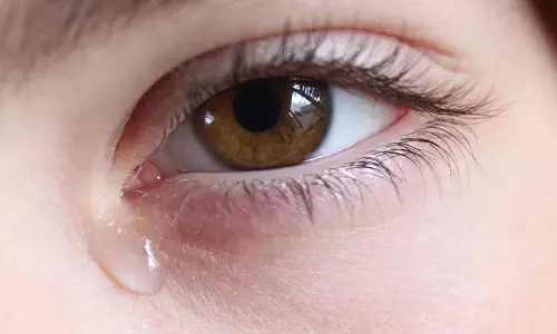 Watery Eyes Problem Expert Explains the Cause and Prevention