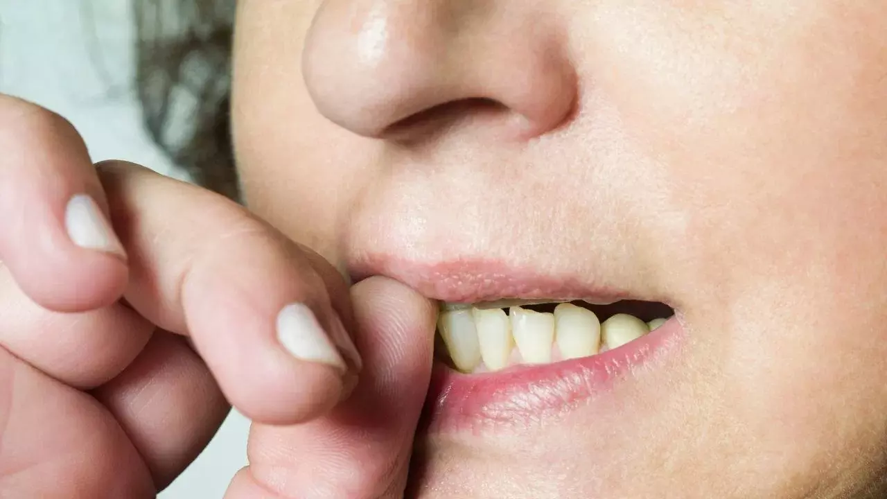 Nail Biting Habit : గోళ్లు కొరికే అలవాటుందా? అయితే జాగ్రత్త.. ఆరోగ్యం, డబ్బు రెండూ పోతాయట