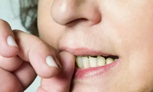 Nail Biting Habit : గోళ్లు కొరికే అలవాటుందా? అయితే జాగ్రత్త.. ఆరోగ్యం, డబ్బు రెండూ పోతాయట