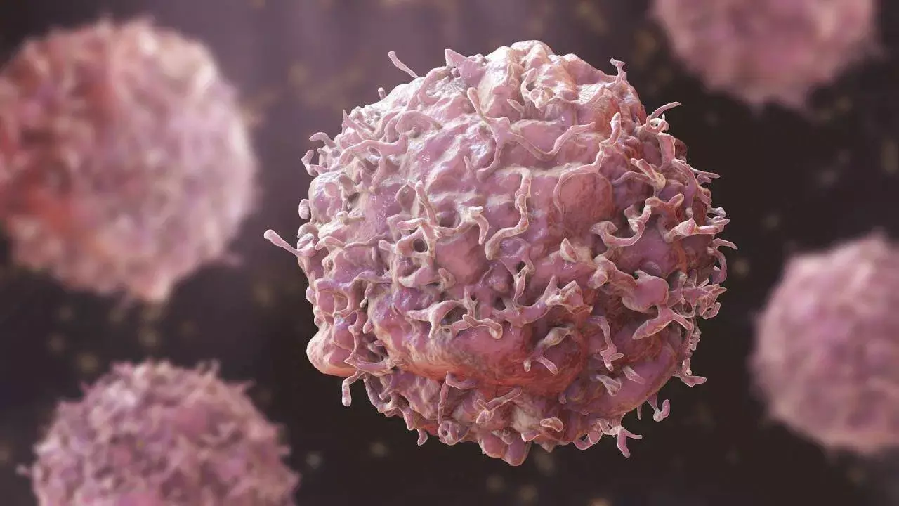 Cancer : క్యాన్సర్​కు వ్యాక్సిన్ వచ్చేసింది.. రష్యా సైంటిస్టుల సంచలన ఆవిష్కరణ