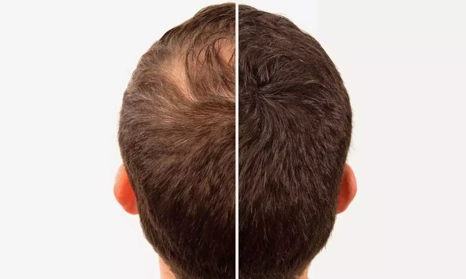 Hair Growth Hair Growth