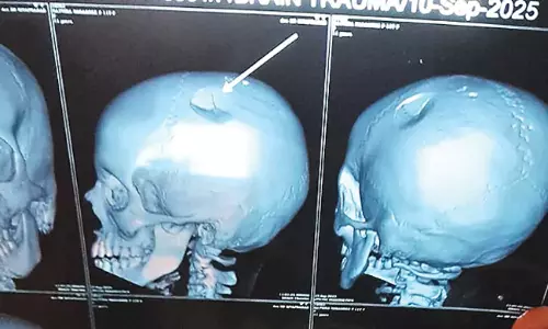 Chittoor: దారుణం.. అల్లరి చేస్తుందని పుర్రె ఎముక చిట్లే విధంగా కొట్టిన టీచర్