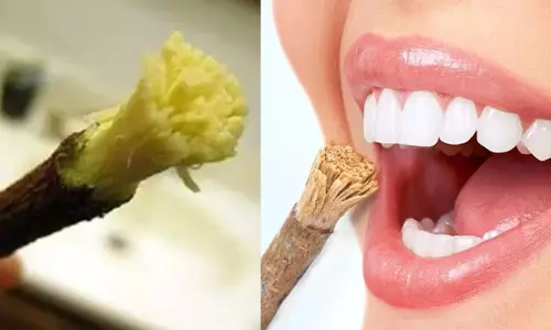 Dental Health : పళ్ళు తెల్లగా, గట్టిగా ఉండాలంటే దీనితో రుద్దండి.. చాలా హెల్తీగా ఉంటాయి