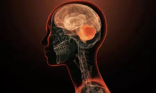 Naegleria fowleri Naegleria fowleri