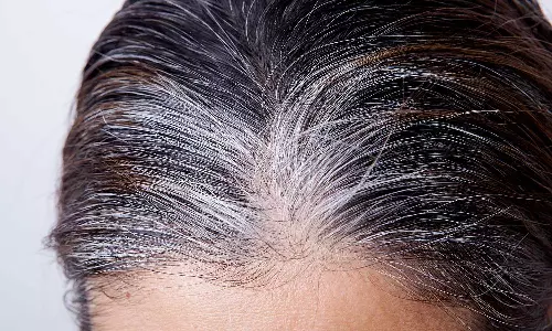 తెల్ల జుట్టు పీకేస్తే మరింత తెల్లబడుతుందా? - నిపుణులు ఏమంటున్నారంటే! తెల్ల జుట్టు పీకేస్తే మరింత తెల్లబడుతుందా? - నిపుణులు ఏమంటున్నారంటే!