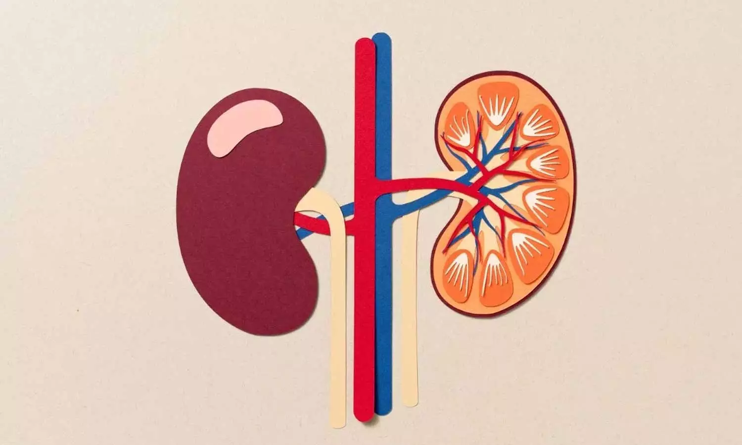 Single Kidney