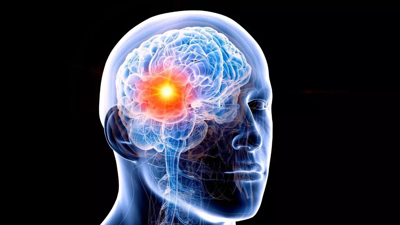 Brain Tumor : రాత్రి పడుకున్నప్పుడు ఈ 3 లక్షణాలు కనిపిస్తే నిర్లక్ష్యం చేయవద్దు