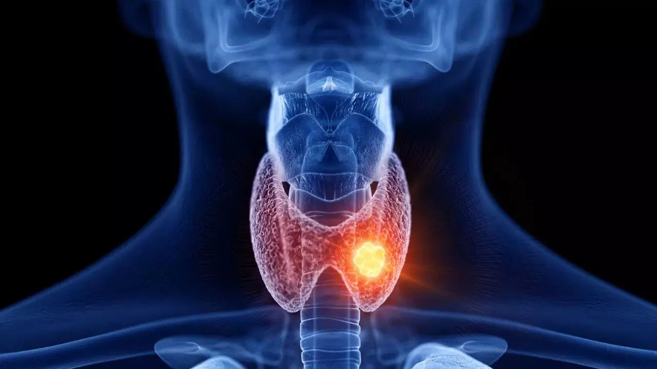 Thyroid Pain : ఈ భాగాల్లో నొప్పి వస్తే నిర్లక్ష్యం చేయొద్దు.. ఇది థైరాయిడ్ లక్షణం కావచ్చు Thyroid Pain : ఈ భాగాల్లో నొప్పి వస్తే నిర్లక్ష్యం చేయొద్దు.. ఇది థైరాయిడ్ లక్షణం కావచ్చు