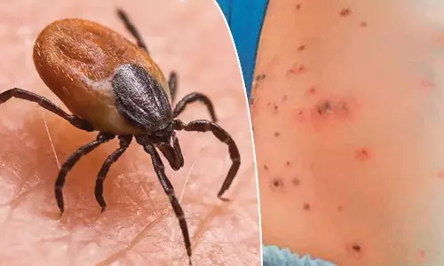 Scrub Typhus: ఏపీని వణికిస్తున్న స్క్రబ్‌ టైఫస్.. వరుస మరణాలు.. భయందోళనలో ప్రజలు