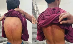 Kompalli: ఏడో తరగతి విద్యార్థిపై దాడి చేయించిన ప్రధానోపాధ్యాయుడు.. !