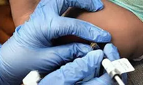 Breakthrough in Diabetes: 14 రోజుల్లో చెక్! భారతీయ శాస్త్రవేత్త సంచలన ఆవిష్కరణ..