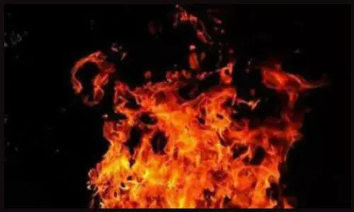 Telangana: బడంగ్పేట్ సర్కిల్‌లో సీఎం రేవంత్ రెడ్డి దిష్టిబొమ్మ దహనం