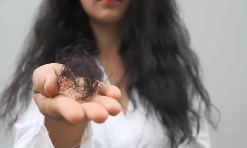 Hair Fall Secret: జుట్టు విపరీతంగా రాలుతోందా? షాంపూలు మార్చడం కాదు.. ముందు ఇది తినండి!