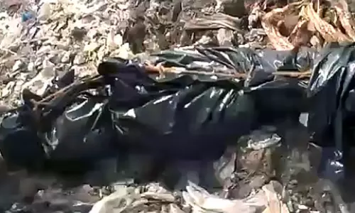 Karimnagar Shock: డంపింగ్ యార్డ్‌లో ప్రత్యక్షమైన మనిషి కాలు