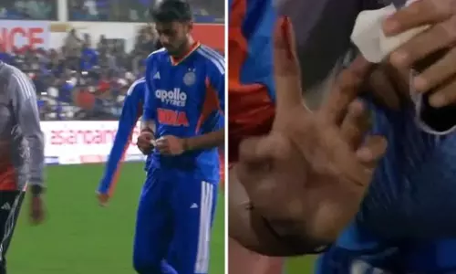 Axar Patel : టీమిండియా గెలిచినా విషాదం..స్టార్ ఆల్‌రౌండర్ అక్షర్ పటేల్‌కు తీవ్ర గాయం