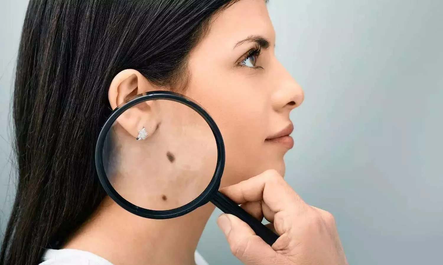 Lucky Moles Lucky Moles