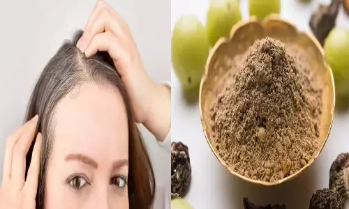 Health tips: తెల్లజుట్టుకు బైబై.. వంటింటి చిట్కాలతో నల్లని మెరిసే జుట్టు!