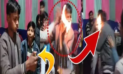 Viral Video: వ్యూస్ కోసం ప్రాణాలతో చెలగాటం: ‘ఫైర్ స్టంట్’ వికటించి బాలుడి ముఖం దగ్ధం.. ఒళ్లు గగుర్పొడిచే వీడియో వైరల్!