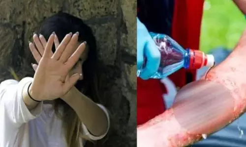 AP Crime News:  వదినపై మరిది ఉన్మాదం: నిద్రిస్తున్న సమయంలో లైంగిక దాడికి యత్నం.. విఫలమవడంతో యాసిడ్ పోసి హత్యాప్రయత్నం!