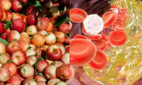 LDL Cut Fruit: రక్తంలో చెడు కొలెస్ట్రాల్‌తో ఇబ్బంది పడుతున్నారా? రోజూ ఈ ఒక పండు తింటే చాలు.. ఫలితం అద్భుతం!